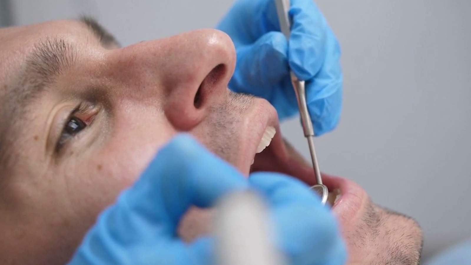 Despite pandemic, dental experts encourage patients to keep up with annual cleanings