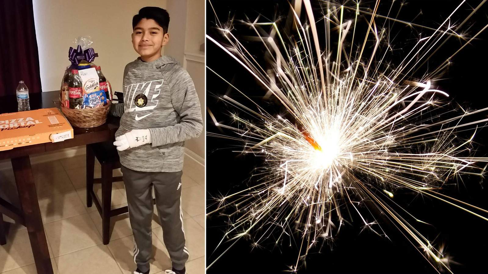 San Antonio teen injured when sparklers ‘exploded’ in his hand warns others about dangers of fireworks