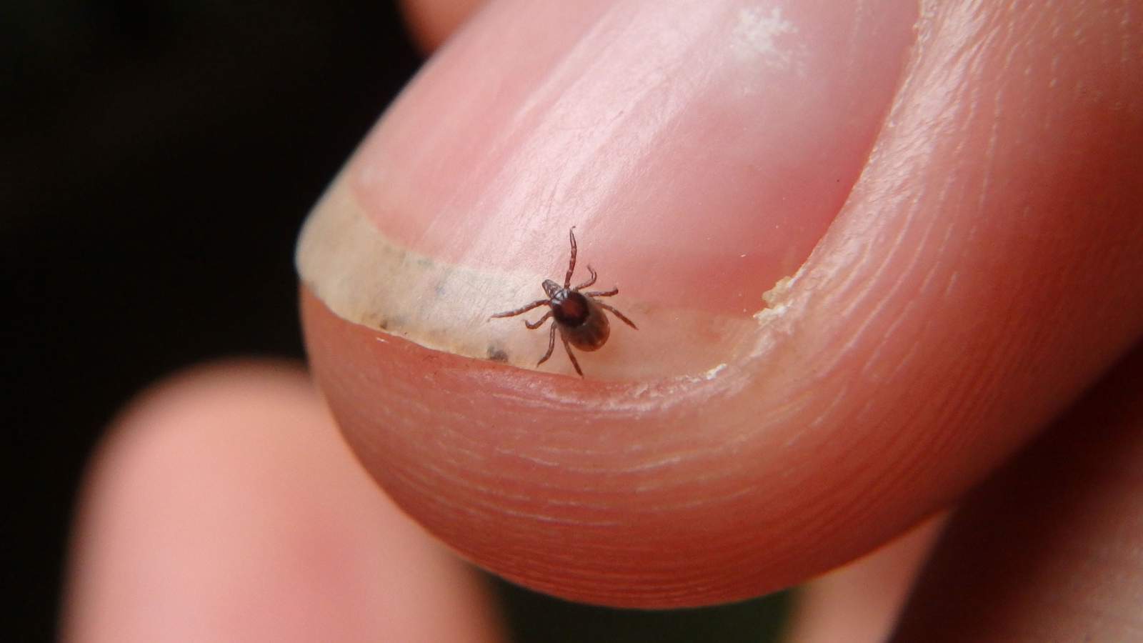 Warmer weather means it’s time to be tick aware