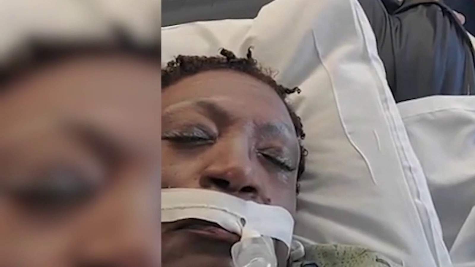 University Health System nurse voluntarily gets put on ventilator to show importance of face masks