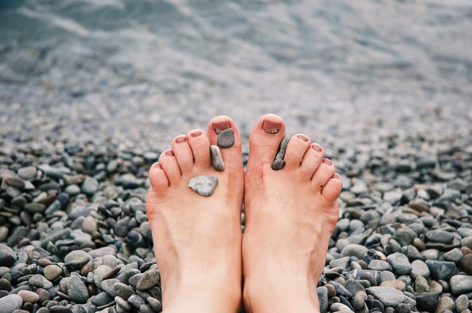 Podcast reminds us, especially in the sandal-wearing months: Stop neglecting your feet