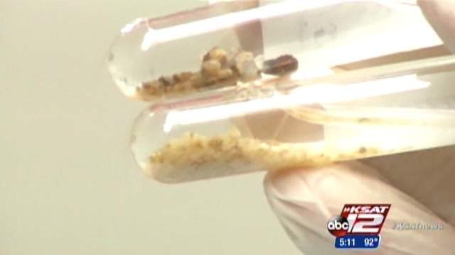 Lasers Used To Blast Away Kidney Stones